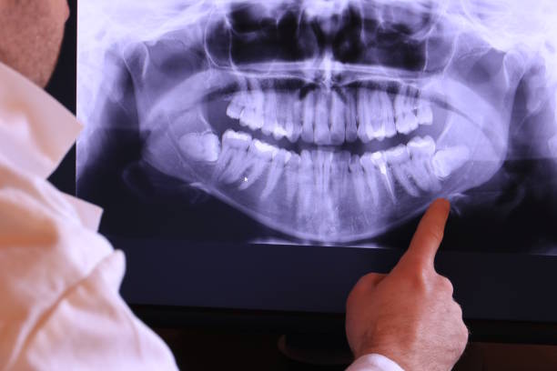 Best Emergency Tooth Extraction in Black Hammock, FL