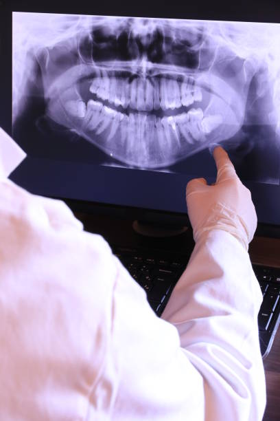 Best Emergency Treatment for Toothache in Black Hammock, FL