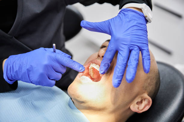 Best Walk-In Emergency Dentist in Black Hammock, FL