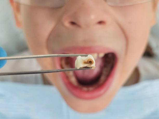 Best Emergency Orthodontic Repairs in Black Hammock, FL